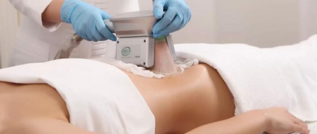 Cryolipolysis For Cellulite