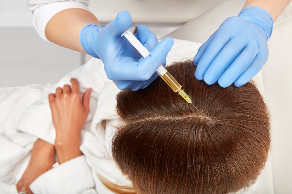 PRP Hair Treatment