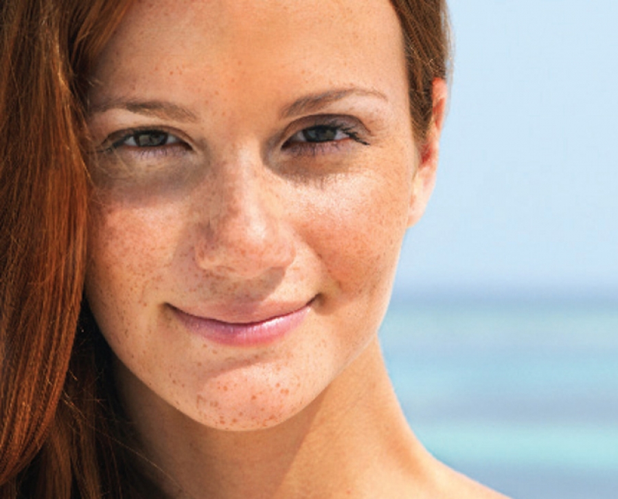 Natural After-Sun Care To Rehydrate Your Skin